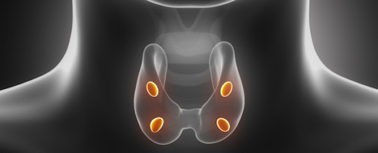 TUMORI DELLE PARATIROIDI (ADENOMA E CARCINOMA)