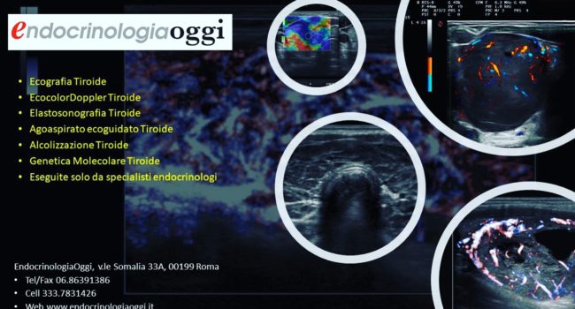 ecografia_tiroide_specialisti_endocrinologia_oggi_roma